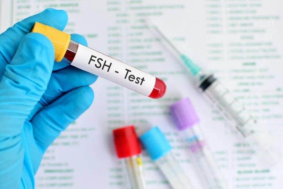 FSH Test: Normal FSH Levels by Age, Menopause, and Fertility Explained