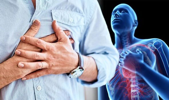 Heart Attack: Its Cause, Symptoms, Prevention, & Treatment