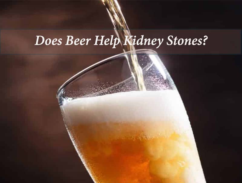 Does Beer Help Kidney Stones?