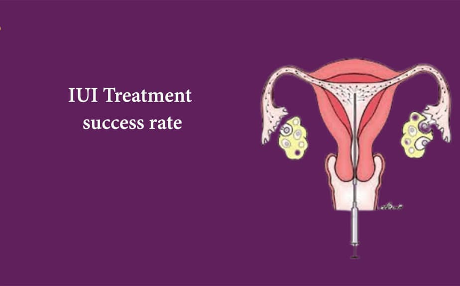 IUI Treatment success rate In 2026