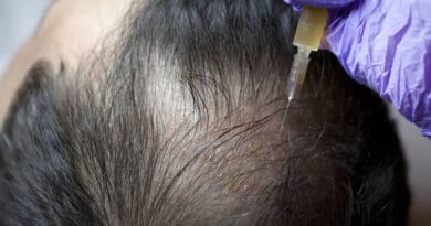 prp-hair-treatment-cost-in-India