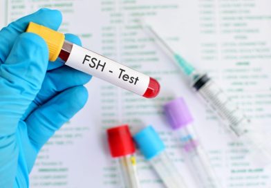 FSH test