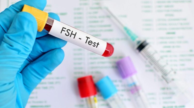 FSH test