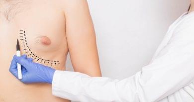 Gynecomastia Surgery Cost In India- Don’t Miss The Opportunity gynecomastia surgery cost In India